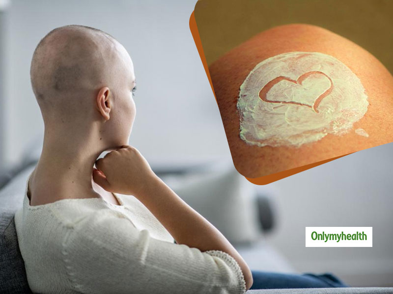 Breast Cancer Awareness Month: Dealing With Dry Skin Due To Chemotherapy? Find Home Remedies Here